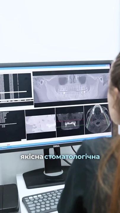 Відео: Dr. Starostin Clinic & Gnathology
